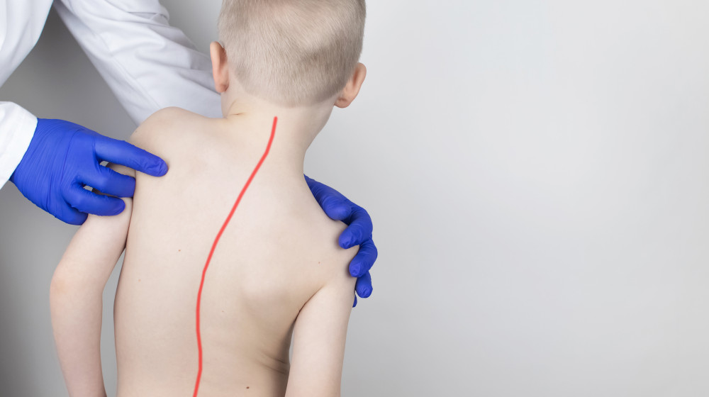 scoliosis surgery